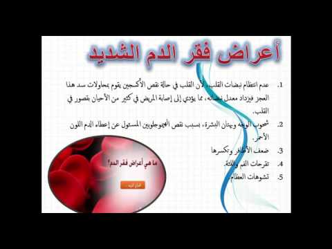 اعراض فقر الدم - مرض فقر الدم ومدى الحماية منه 454