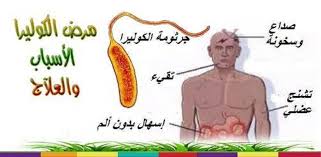 مرض الكوليرا , اعراض وطرق علاج مرض الكوليرا