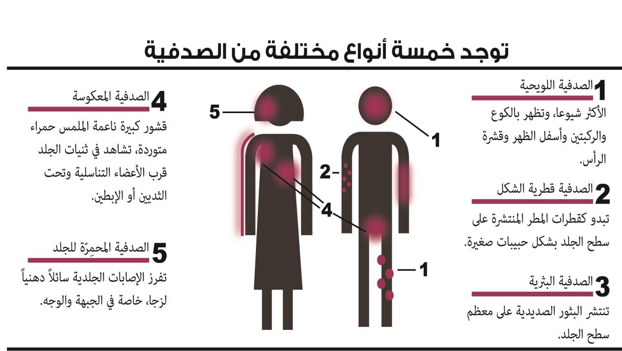 علاج الصدفية بالاعشاب - تعرف على مرض الصدفية وعلاجه بالاعشاب 1965 3