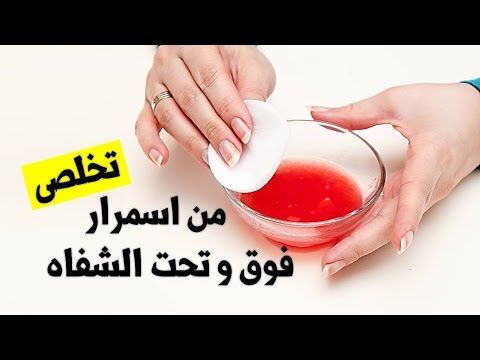 علاج تساقط الشعر - افضل العلاجات لتساقط الشعر 533 1