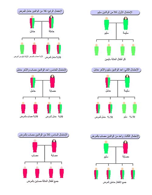 مرض الثلاسيميا - اعراض مرض الثلاسيميا