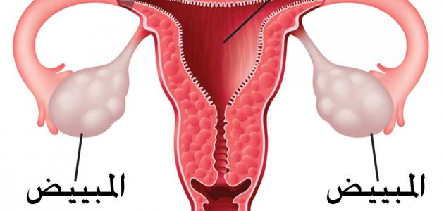 لحمية الرحم وعلاجها بالاعشاب - افضل الطرق لعلاج لحميه الرحم 12472 1