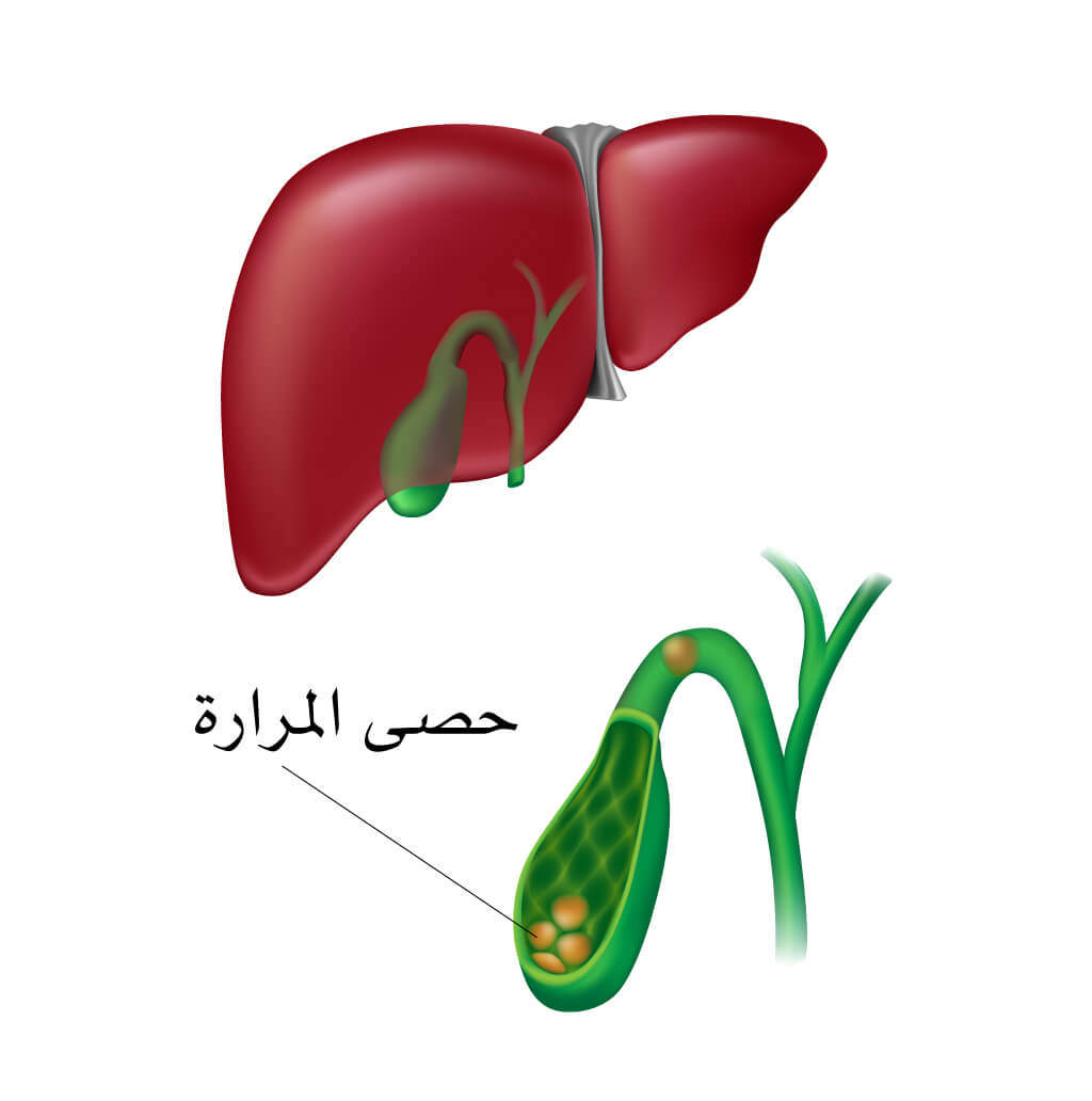 هل استئصال المراره يؤثر على الحمل - استئصال المراره وتأثيرها على الحمل 12401 3