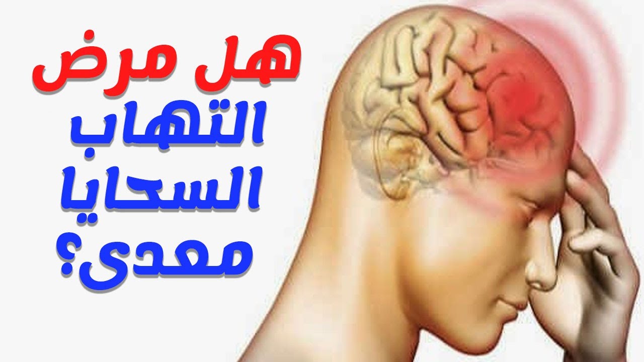 مرض السحايا - ماهو مرض السحايا وطرق علاجه 3445 1