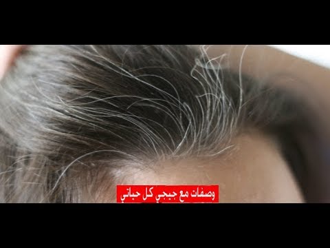 علاج الشيب المبكر - الوقاية من مرض الشيب المبكر 567 1