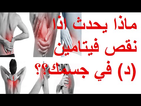 ماهي اعراض نقص فيتامين د , اهم اعراض نقص فيتامين د