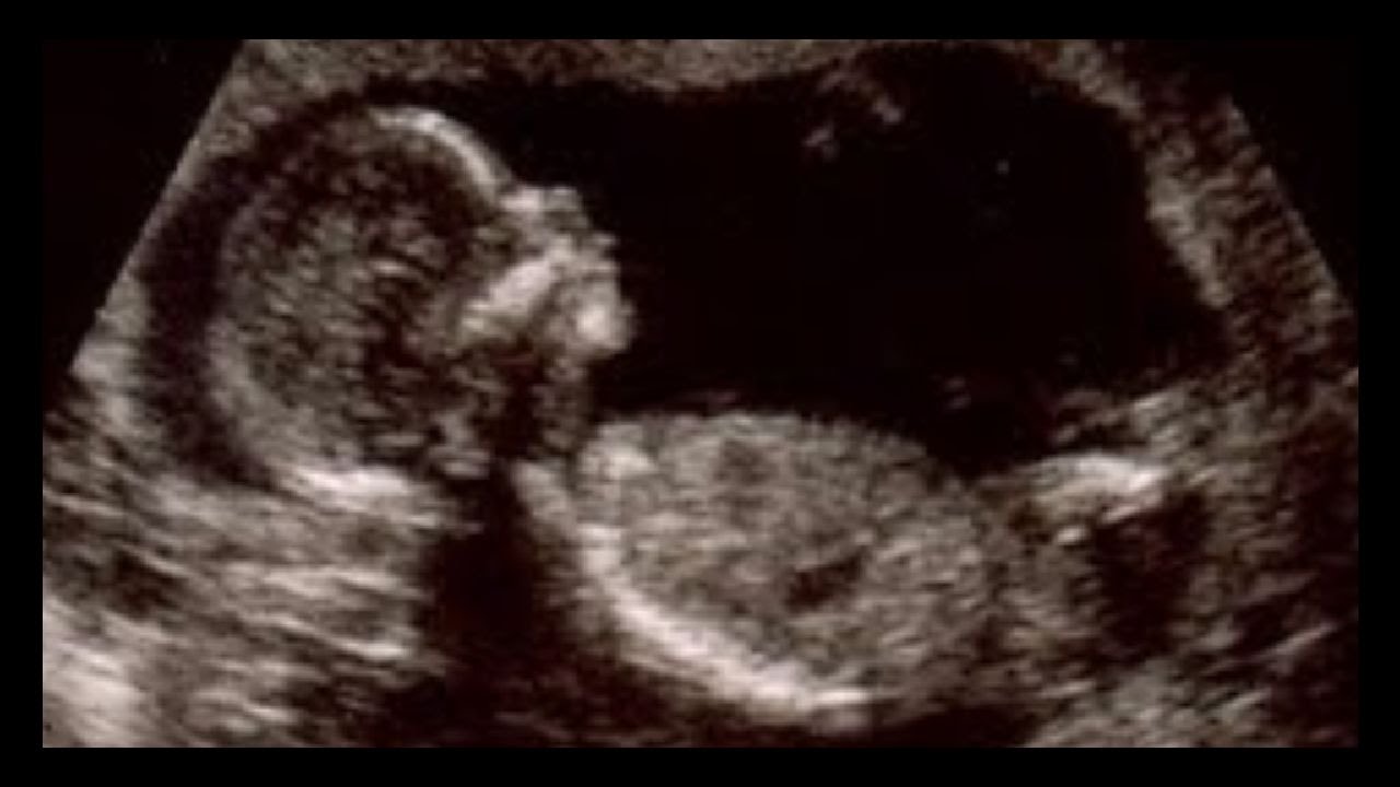 علامات الحمل بولد في الشهر الثاني صفات تبين للمراه انها حامل فى شهرها الثانى صور بنات
